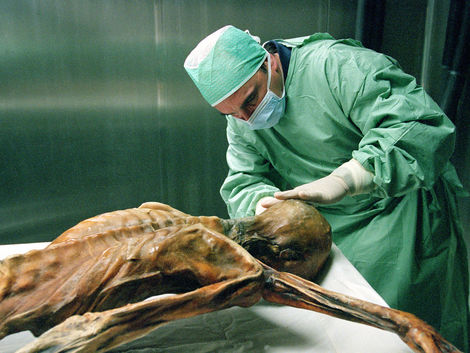 otzi