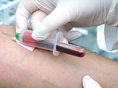 leukemia, krv, branie krvy, odber, iniekcia