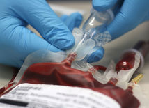 V USA zrušili zákaz darovania krvi gejmi a bisexuálmi