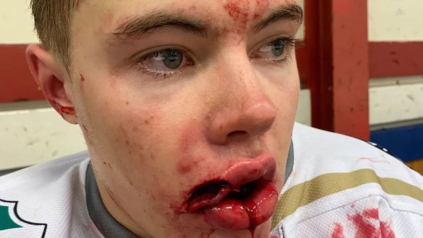 Massacre in Sweden.  A brutal attack came for harmless provocation – Other – Hockey – Sport