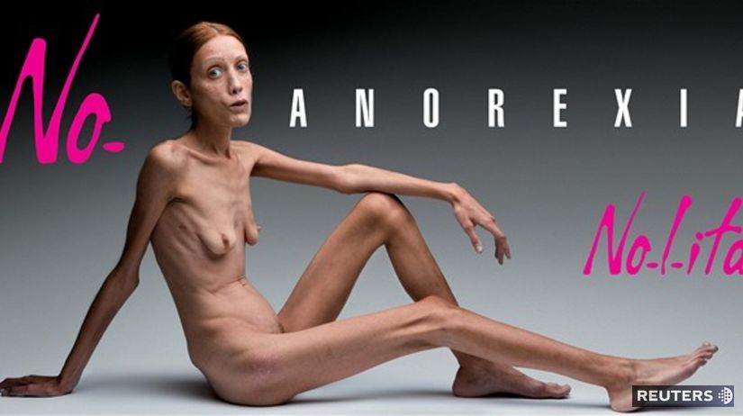 kampaň proti anorexii - Isabelle Caro