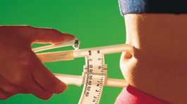 Viac ako tretina Slovákov trpí nadváhou