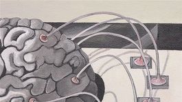 Roztrúsená skleróza má tisíc tvárí