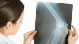 Keď v kolene chrupne a v ramene lupne