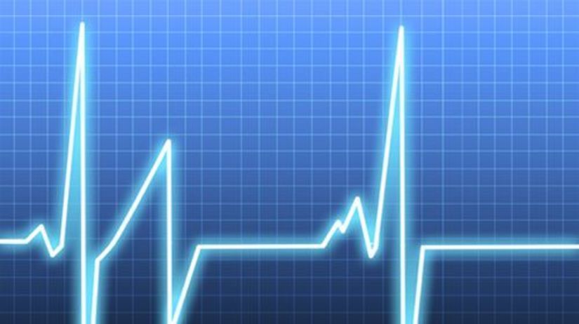 srdce - rytmus - EKG