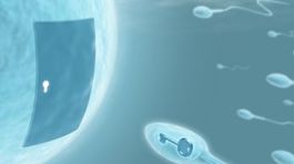 Vnútromaternicové oplodnenie alebo Intrauterinná inseminácia – IUI