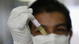  V materskej škole neďaleko Piešťan sa objavila prasacia chrípka