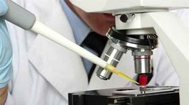 Rakovina: Včasná diagnostika, menej úmrtí