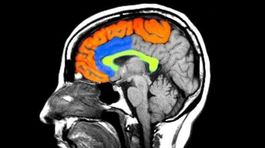 Schizofrénia vydala svoje genetické tajomstvá
