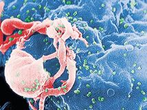 AIDS, HIV