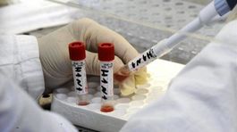 Osýpkami v Brazílii trpí vyše 1550 ľudí, sedem už zomrelo