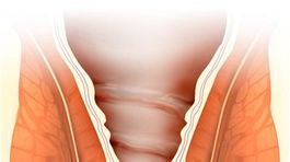 Zlatá žila je ľudová choroba dneška