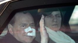 Berlusconi, zranenie