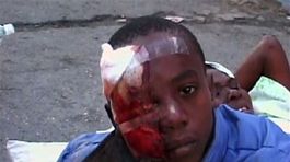 Haiti, obeť, ranený