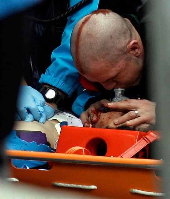 Lekári oživujú gruzínskeho sánkara Nodara...