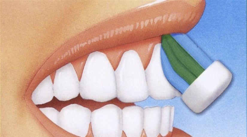 čistenie ústnej dutiny - krok 1