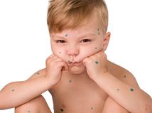 osýpky - dieťa - infekcia -