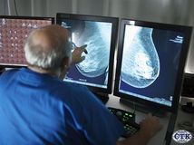 mamograf, rakovina prsníka, prsník