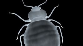 Parazity, pohreby, obojky... 7+1 zvláštnych múzeí zo sveta aj Slovenska