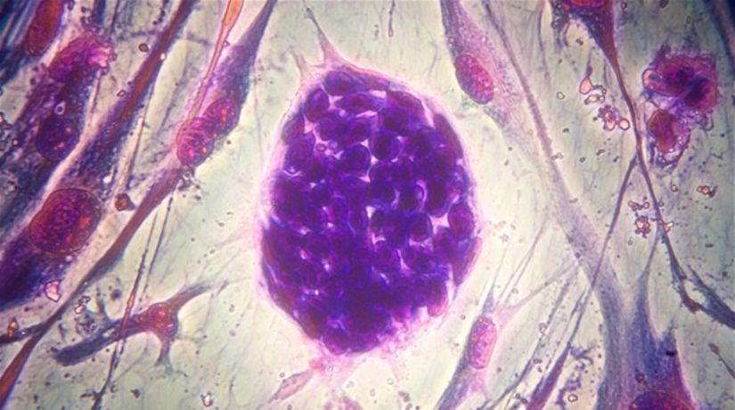 kmeňová bunka