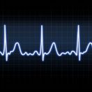 srdce, rytmus, EKG, arytmia, echo, krivka, kardio, infarkt
