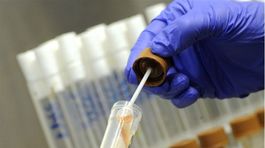 V USA objavili superbaktérie odolné voči liekom