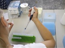 E.coli, EHEC, črevná baktéria, laboratórium, skúmavky