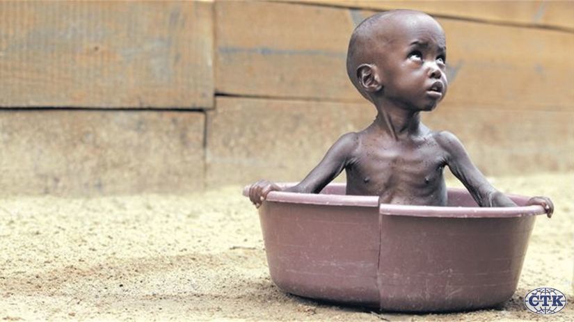 Hladomor, Afrika, dieťa