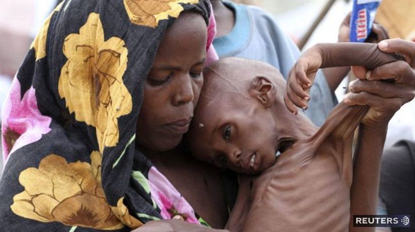 Somálsko, hlad, smäd, sucho, hladomor