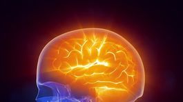 Cievna mozgová príhoda postihuje stále mladších ľudí