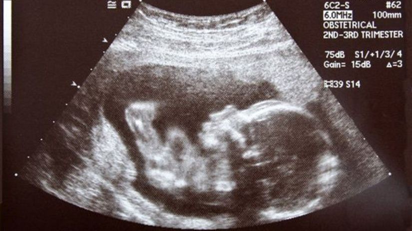 embry, plod, dieťa, tehotenstvo, ultrazvuk