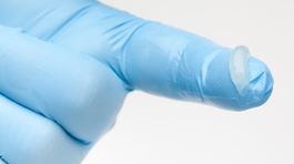 Hemoroidy znepríjemňujú život