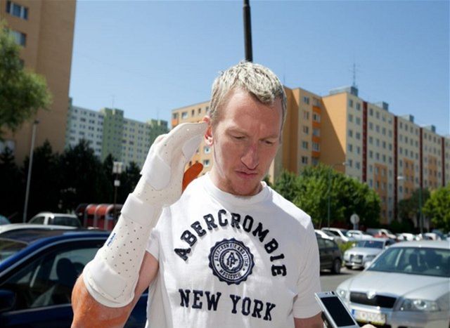 Marcel Hossa absolvoval operáciu zranenej ruky.