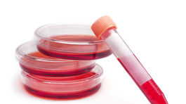 V Rusku sa šíri epidémia AIDS, vláda bije na poplach