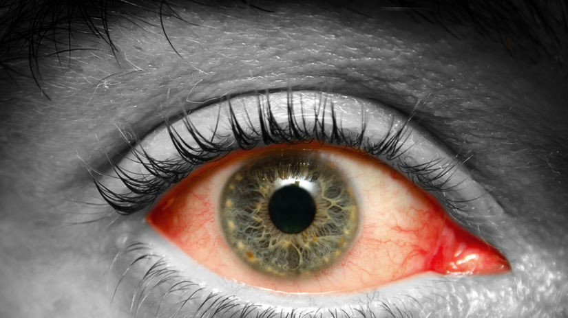 oko - poškodenie oka - očné choroby