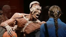 Aktivisti budú protestovať proti výstave The Human Body