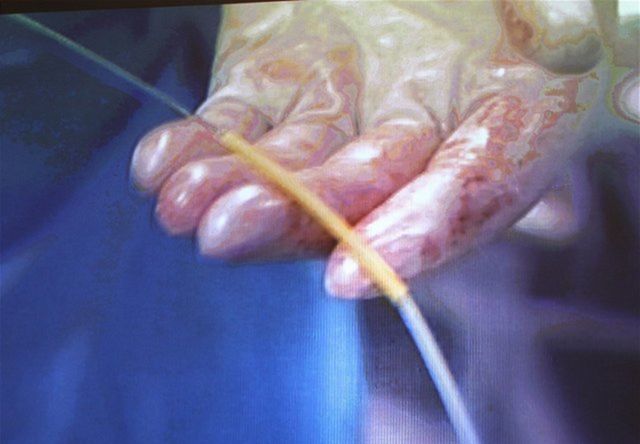 Snímka zo zákroku.