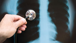 Novým vírusom sa v Číne nakazilo už vyše 200 ľudí