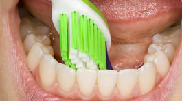 Pred raňajkami či po nich? Kedy si treba čistiť zuby? 