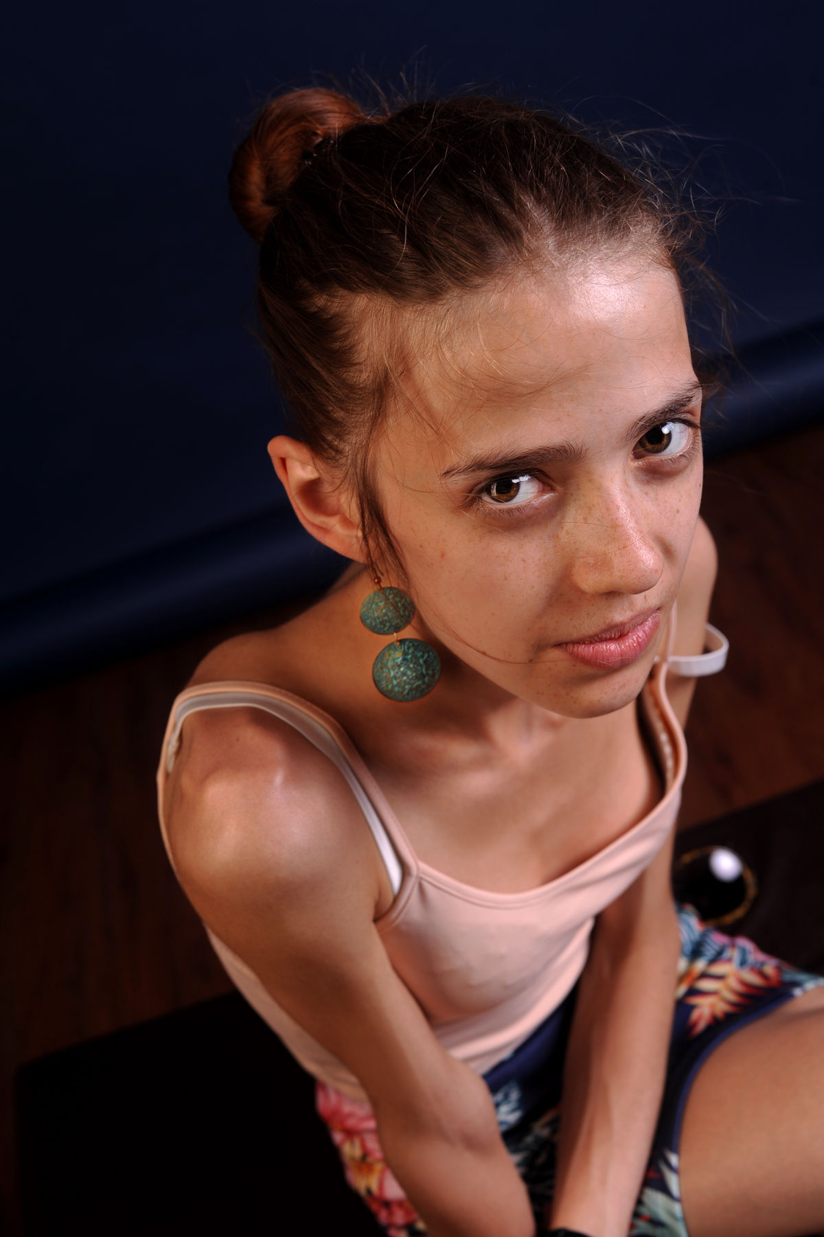 Mentálna anorexia patrí medzi potenciálne...