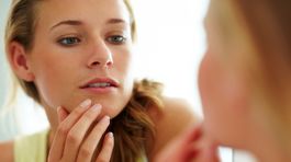 Zrkadlo vás nepotešilo - dvojitá brada je čoraz viditeľnejšia? Čo môže zabrať?