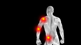 Choroby pohybového aparátu trápia viac ženy ako mužov