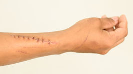 Jazvu treba pred slnkom chrániť rok