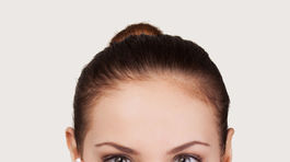 Päť účinných domácich prostriedkov na komedony