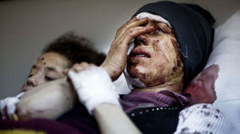 Sýria, zranenie