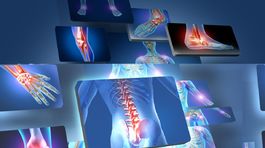 Bolestí kĺbov sa môžete zbaviť aj v sedemdesiatke