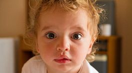 Úsmevy preťaté rázštepom