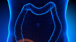 Zápal slepého čreva sa vždy prejavuje bolesťou brucha