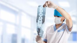 Šesť mýtov o bolesti chrbtice: Pokoj, tabletky a cvičenie? Ani nie