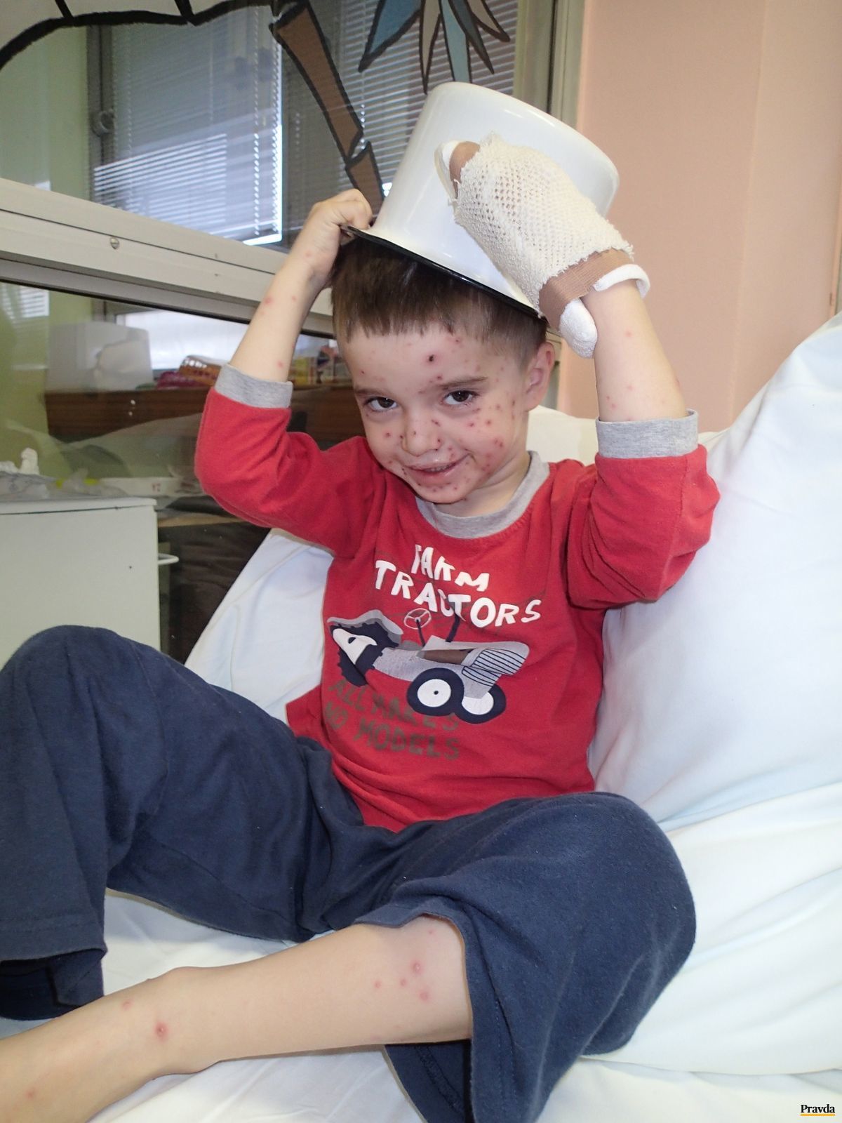 Bodkovaná tvár, plechový nemocničný nočník na...